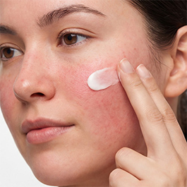 Alantel Crema calmante sin corticoides para el picor e irritación