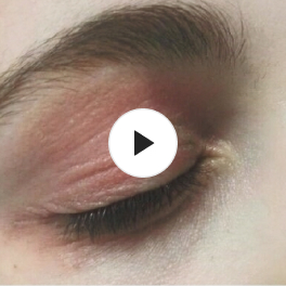 Alantel Crema calmante sin corticoides para el picor e irritación